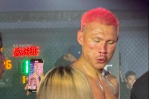 ??骨折了？惡鼠被威姆斯一拳打到面門！鼻梁已經(jīng)出現(xiàn)嚴重歪斜！